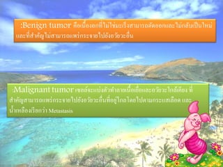 :Benign tumor คือเนื้องอกที่ไม่ใช่มะเร็ งสามารถตัดออกและไม่กลับเป็ นใหม่
  และที่สาคัญไม่สามารถแพร่ กระจายไปยังอวัยวะอื่น




 :Malignant tumor เซลล์จะแบ่งตัวทาลายเนื้อเยือและอวัยวะใกล้เคียง ที่
                                                  ่
                                           ่
สาคัญสามารถแพร่ กระจายไปยังอวัยวะอื่นที่อยูไกลโดยไปตามกระแสเลือด และ
น้ าเหลืองเรี ยกว่า Metastasis
 
