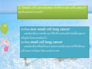 2. Small cell carcinoma หรื อที่เรี ยก oat cell cancer
พบน้อยแต่แพร่ กระจายเร็ ว



  การรักษา non-small cell lung cancer
      แพทย์จะเลือกการผ่าตัด และให้รังสี ร่วมกับเคมีบาบัดเพื่อหยุดการ
  เจริ ญเติบโตของเซลล์มะเร็ ง
  การรักษา small cell lung cancer
      แพทย์จะเลือกให้เคมีรักษาร่ วมกับการผ่าตัด และอาจให้รังสี รักษา
        ่
  แม้วาจะตรวจไม่พบว่ามีการแพร่ กระจาย
 