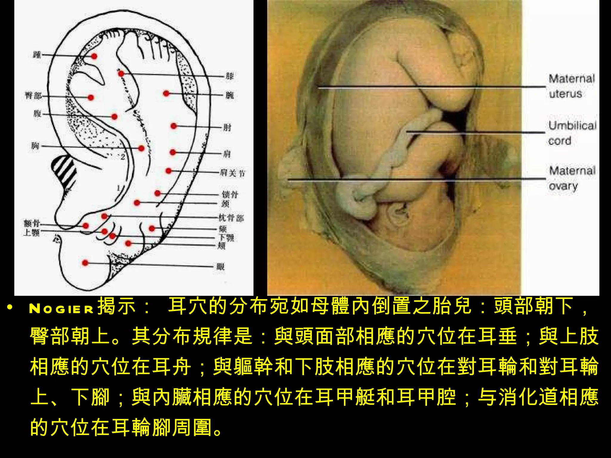 法国医师的研究 Nogier 揭示： 耳穴的分布宛如母 體內 倒置之胎 兒 ： 頭 部朝下，臀部朝上。其分布 規 律是： 與頭 面部相 應 的穴位在耳垂； 與 上肢相 應 的穴位在耳舟； 與軀幹 和下肢相 應 的穴位在 對 耳 輪 和 對 耳 輪 上、下 腳 ； 與內臟 相 應 的穴位在耳甲艇和耳甲腔；与消化道相 應 的穴位在耳 輪腳 周 圍 。  