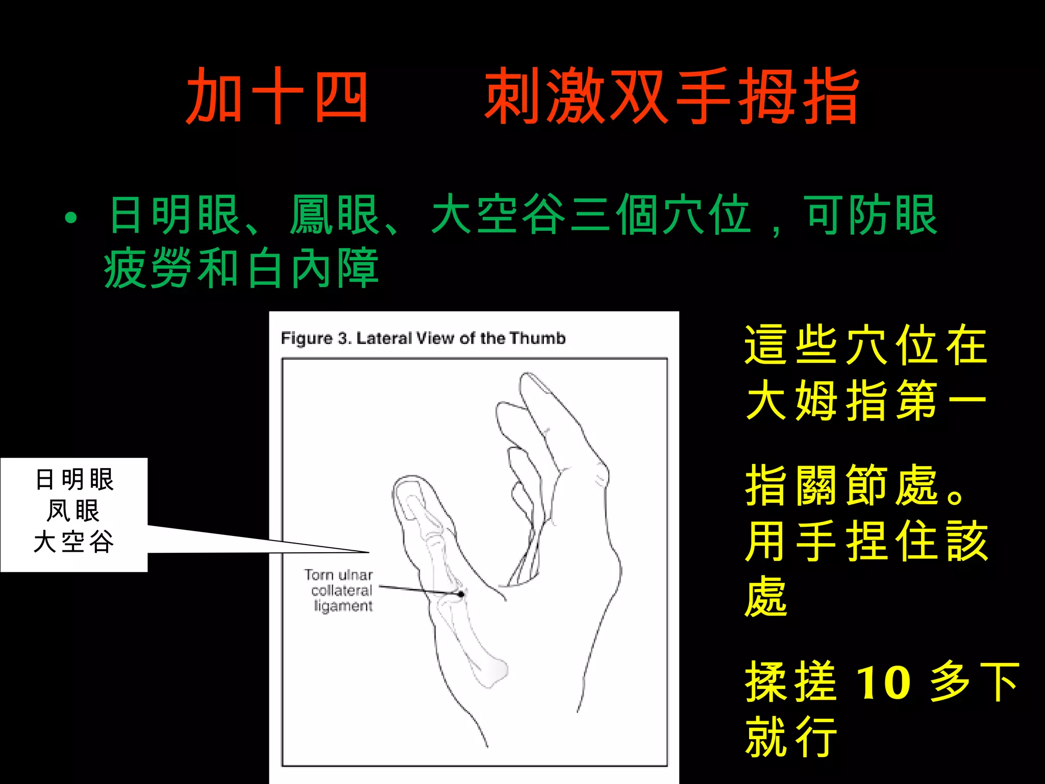 加十四  刺激双手拇指 日明眼、 鳳 眼、大空谷三 個 穴位，可防眼疲 勞 和白 內 障 日明眼 凤眼 大空谷 這 些穴位在大姆指第一 指 關節處 。用手捏住 該處 揉搓 10 多下就行 