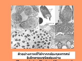 ตัวอย่างภาพที่ได้จากกล้องจุลทรรศน์อิเล็กตรอนชนิดส่องผ่าน (Transmission Electron Microscope) 