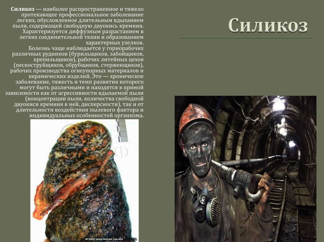 Профессиональная болезнь шахтеров. Как профзаболевания получают шахтеры. Профессиональные заболевания горнорабочих. Профессиональная болезнь шахтеров. Профессиональные болезни.