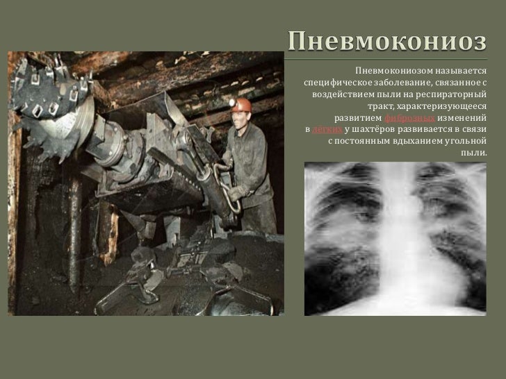 Чем отличается силикоз от силикатоза. Горнорабочий для презентации. Антракоз вид легкого шахтера. Силикатозы патогенез. Профессиональные заболевания шахтеров.