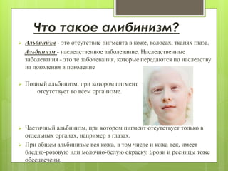 Альбинизм | PPT