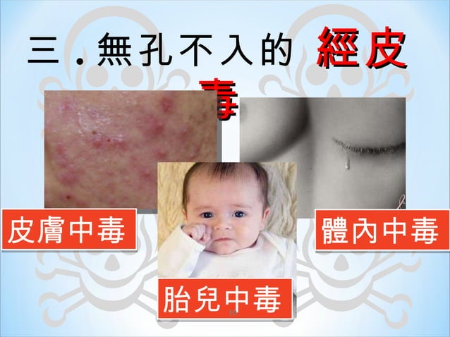 認識經皮毒 | PPT