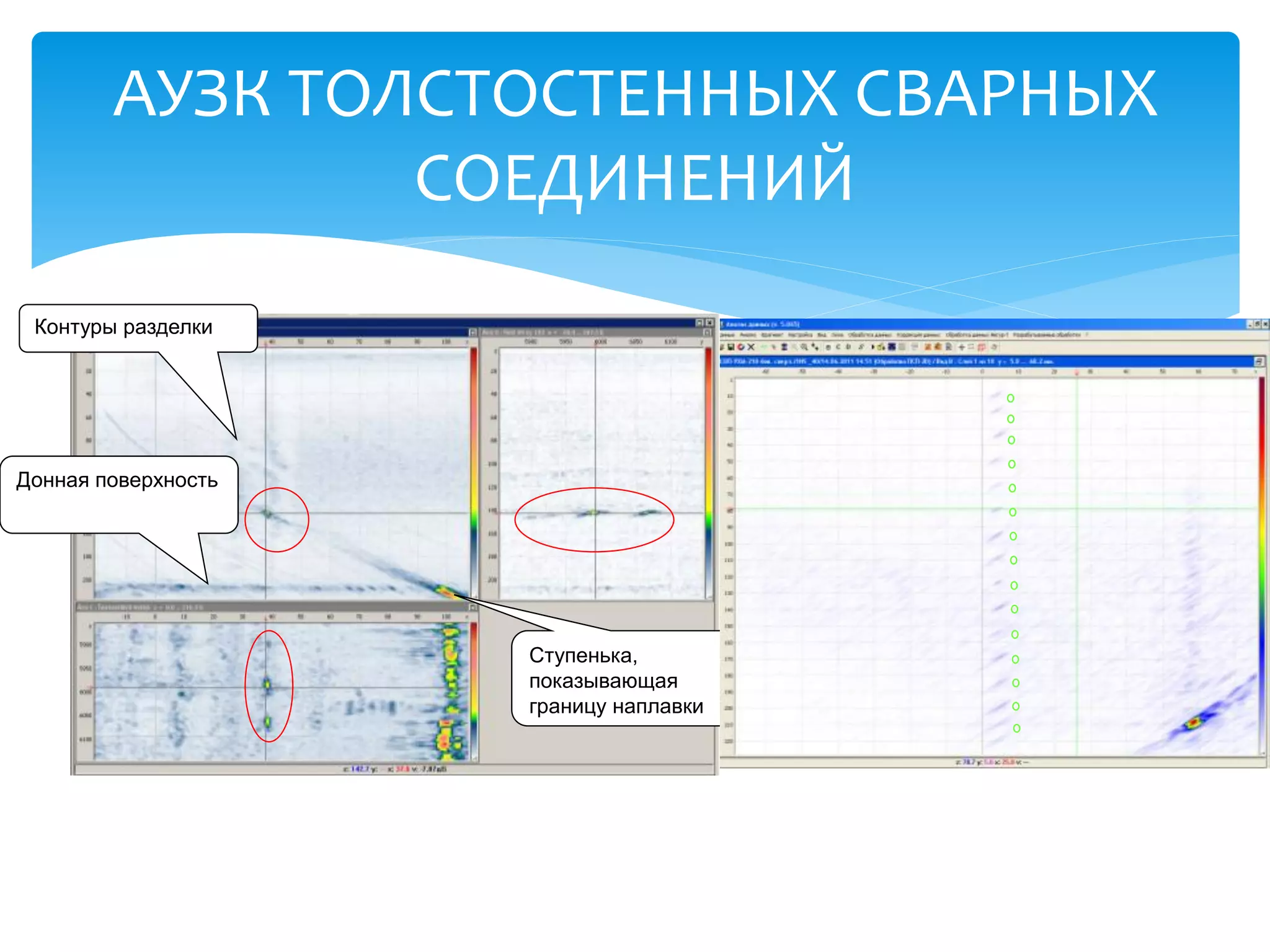 АУЗК ТОЛСТОСТЕННЫХ СВАРНЫХ
                СОЕДИНЕНИЙ
 Контуры разделки




Донная поверхность




                     Ступенька,
                     показывающая
                     границу наплавки
 