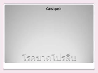 Cassiopeia
 