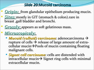 Slide 20  :Mucoid carcinoma Origin:   from glandular epithelium producing mucin. Sites:  mostly in GIT (stomach & colon).rare in breast ,gall bladder and bronchi. Grossly:   appears as soft gelatinous mass . Microscopicaly:   Mucoid (colloid) carcinoma : adenocarcinoma    rupture of cells    release of large amount of extra-cellular mucin  Pools of mucin containing floating malignant cells. Signet cell carcinoma : cells are distended with intracellular mucin   Signet ring cells with minimal extracellular mucin. 