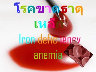 โ ร ค ข า ด ธ า ตุ เ ห ล็ ก   Iron   defic  iency   anem ia   