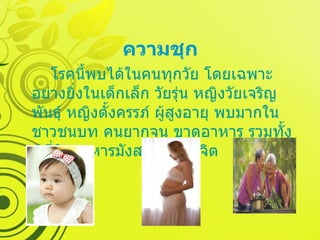 ความชุก โรคนี้พบได้ในคนทุกวัย โดยเฉพาะอย่างยิ่งในเด็กเล็ก วัยรุ่น หญิงวัยเจริญพันธุ์ หญิงตั้งครรภ์ ผู้สูงอายุ พบมากในชาวชนบท คนยากจน ขาดอาหาร รวมทั้งผู้ที่กินอาหารมังสวิรัติ  ชีวจิต 