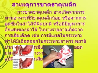 สาเหตุการขาดธาตุเหล็ก การขาดธาตุเหล็ก อาจเกิดจากการทานอาหารที่มีธาตุเหล็กน้อย หรือจากการดูดซึมในลำไส้ที่ผิดปกติ หรือมีปัญหาการอักเสบของลำไส้ ในบางรายอาจเกิดจากการเสียเลือด เช่น การมีแผลในกระเพาะ ทำให้มีเลือดออกในกระเพาะอาหาร , พยาธิปากขอ ,  หรือการมีเลือดประจำเดือนออกมากในผู้หญิงบางราย หรือเกิดจากอุบัติเหตุที่มีการเสียเลือดมาก 