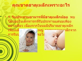 คุณขาดธาตุเหล็กเพราะอะไร 1.  รับประทานอาหารที่มีธาตุเหล็กน้อย   พบได้บ่อยในเด็กทารกที่รับประทานแต่นมเพียงอย่างเดียว เนื่องจากในนมมีปริมาณธาตุเหล็กเพียงเล็กน้อย  ในผู้ใหญ่ การขาดธาตุเหล็กจากการรับประทานน้อยเจอได้ไม่บ่อย  