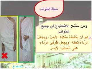 ‫ف‬
          ‫صفة الطوا ِ‬




‫الضطباع‬
 