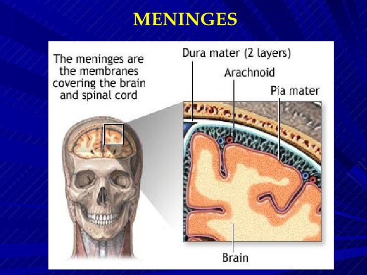 meningitis case study slideshare
