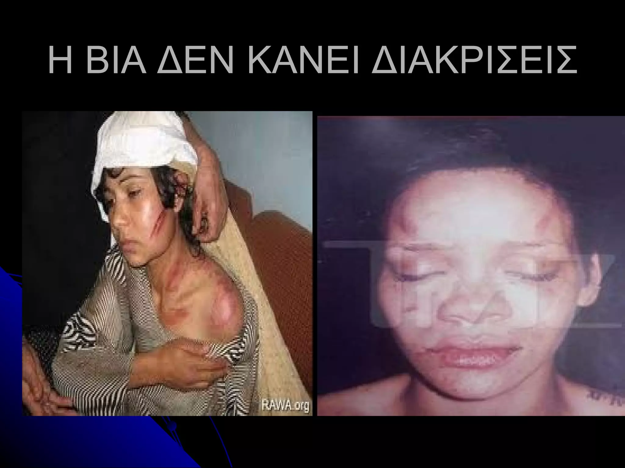 Η ΒΙΑ ΔΕΝ ΚΑΝΕΙ ΔΙΑΚΡΙΣΕΙΣ
 