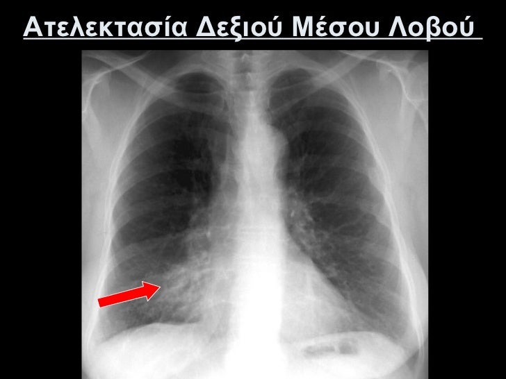 Ermhneia Aktinografias 8wrakos