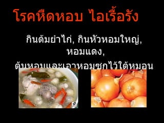 โรคหืดหอบ ไอเรืำอรัง
   กินต้มยำาไก่, กินหัวหอมใหญ่,
             หอมแดง,
ต้นหอมและเอาหอมซุกไว้ใต้หมอน
 