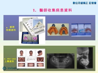 1. 醫師收集病患資料



  a. 郵寄
  取模資料




b . O n - lin e
上傳資料
 