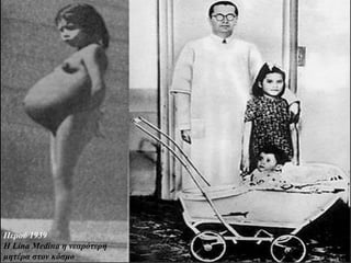 Περού 1939
Η Lina Medina η νεαρότερη
μητέρα στον κόσμο
 