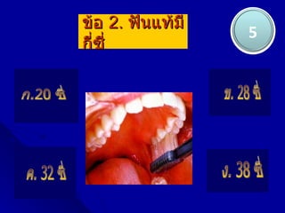 ข้อ 2. ฟันแท้มี
                  5
กี่ซี่
 