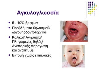 Αγκυλογλωσσία
   5 - 10% βρεφών
   Προβλήματα θηλασμού/
    λόγου/ οδοντοτεχνικά
   Κολικοί/ Ανησυχία/
    Πληγωμένες θηλές/
    Ανεπαρκής παραγωγή
    και ανάπτυξη
   Εκτομή χωρίς επιπλοκές
 