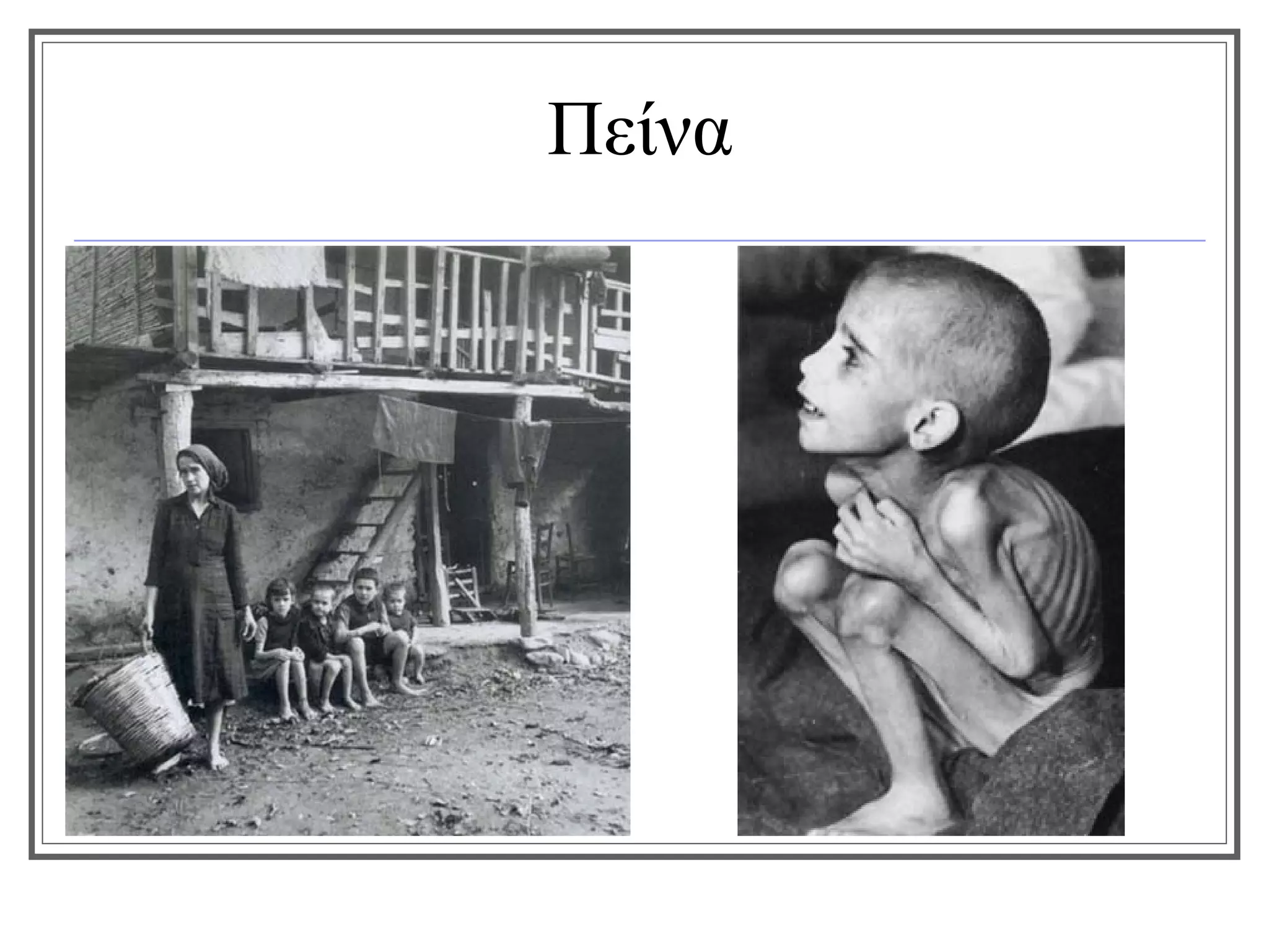 Πείνα
 