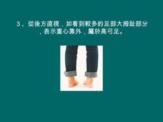 ３、從後方直視，如看到較多的足部大拇趾部分
    ，表示重心靠外，屬於高弓足。
 