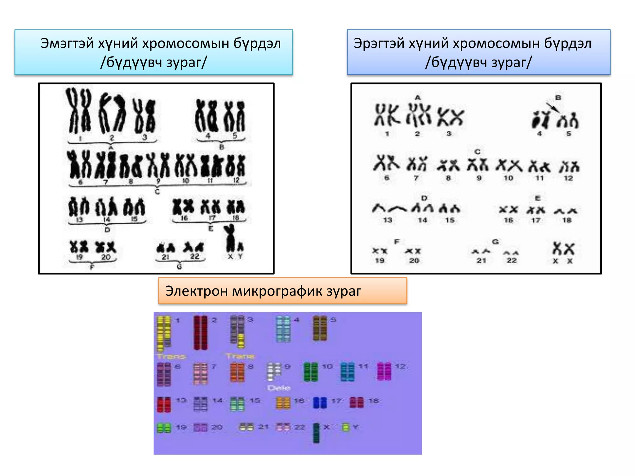 Эмэгтэй хүний хромосомын бүрдэл         Эрэгтэй хүний хромосомын бүрдэл
        /бүдүүвч зураг/                           /бүдүүвч зураг/




                Электрон микрографик зураг
 