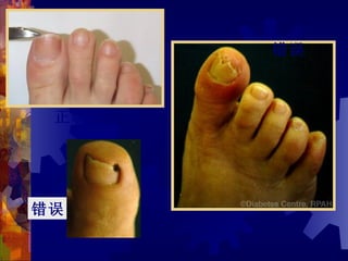 错误



 正确




错误
 