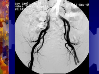 国际奥比斯糖尿病视网膜病变防治讲座（糖尿病教育、糖尿病足）