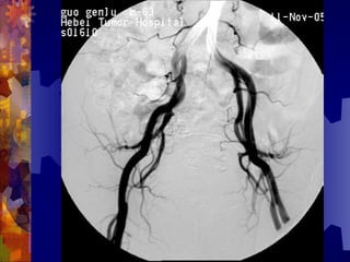 国际奥比斯糖尿病视网膜病变防治讲座（糖尿病教育、糖尿病足）