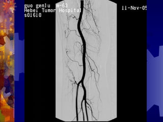 国际奥比斯糖尿病视网膜病变防治讲座（糖尿病教育、糖尿病足）