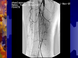 国际奥比斯糖尿病视网膜病变防治讲座（糖尿病教育、糖尿病足）