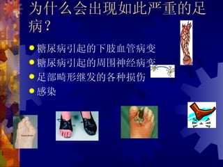 为什么会出现如此严重的足
病？
 糖尿病引起的下肢血管病变
 糖尿病引起的周围神经病变
 足部畸形继发的各种损伤
 感染
 