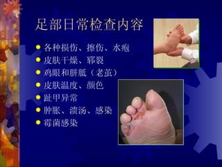足部日常检查内容
 各种损伤、擦伤、水疱
 皮肤干燥、郓裂
 鸡眼和胼胝（老茧）
 皮肤温度、颜色
 趾甲异常
 肿胀、溃汤、感染
 霉菌感染
 