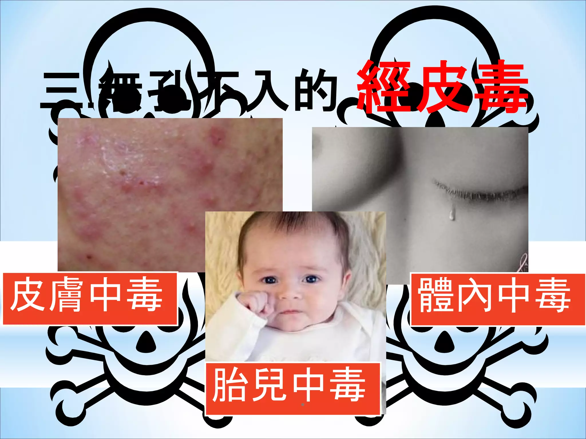 經皮毒 | PDF