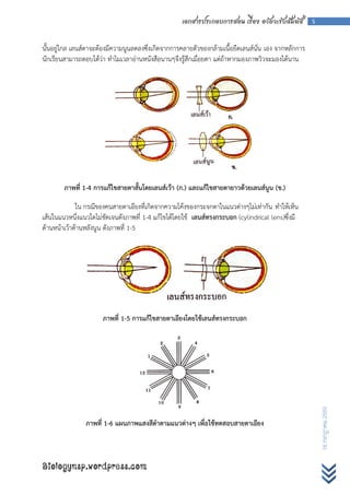 เอกสารประกอบการสอน เรื่อง อวัยวะรับสัมผัส         5



นั้นอยู่ไกล เลนส์ตาจะต้องมีความนูนลดลงซึ่งเกิดจากการคลายตัวของกล้ามเนื้อยึดเลนส์นั่น เอง จากหลักการ
นักเรียนสามารถตอบได้ว่า ทาไมเวลาอ่านหนังสือนานๆจึงรู้สึกเมื่อยตา แต่ถ้าหากมองภาพวิวจะมองได้นาน




        ภาพที่ 1-4 การแก้ไขสายตาสั้นโดยเลนส์เว้า (ก.) และแก้ไขสายตายาวด้วยเลนส์นูน (ข.)

             ใน กรณีของคนสายตาเอียงที่เกิดจากความโค้งของกระจกตาในแนวต่างๆไม่เท่ากัน ทาให้เห็น
เส้นในแนวหนึ่งแนวใดไม่ชัดเจนดังภาพที่ 1-4 แก้ไขได้โดยใช้ เลนส์ทรงกระบอก (cylindrical lens)ซึ่งมี
ด้านหน้าเว้าด้านหลังนูน ดังภาพที่ 1-5




                      ภาพที่ 1-5 การแก้ไขสายตาเอียงโดยใช้เลนส์ทรงกระบอก
                                                                                                          16 กรกฎาคม 2555




                ภาพที่ 1-6 แผนภาพแสงสีดาตามแนวต่างๆ เพื่อใช้ทดสอบสายตาเอียง



Biologynsp.wordpress.com
 