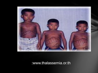 :www.thalassemia.or.th
 