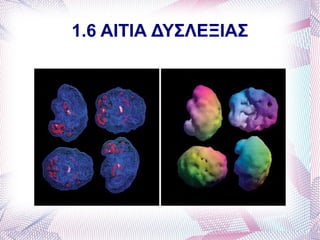 1.6 ΑΙΤΙΑ ΔΥΣΛΕΞΙΑΣ
 