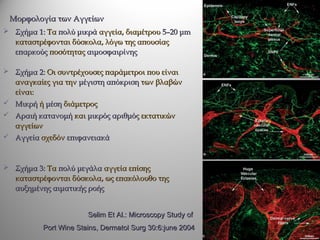 Μορφολογία των Αγγείων
 Σχήμα 1: Τα πολύ μικρά αγγεία, διαμέτρου 5–20 μm
  καταστρέφονται δύσκολα, λόγω της απουσίας
  επαρκούς ποσότητας αιμοσφαιρίνης

 Σχήμα 2: Οι συντρέχουσες παράμετροι που είναι
  αναγκαίες για την μέγιστη απόκριση των βλαβών
  είναι:
 Μικρή ή μέση διάμετρος
 Αραιή κατανομή και μικρός αριθμός εκτατικών
  αγγείων
 Αγγεία σχεδόν επιφανειακά



 Σχήμα 3: Τα πολύ μεγάλα αγγεία επίσης
  καταστρέφονται δύσκολα, ως επακόλουθο της
  αυξημένης αιματικής ροής


                       Selim Et Al.: Microscopy Study οf
          Port Wine Stains, Dermatol Surg 30:6:june 2004
 