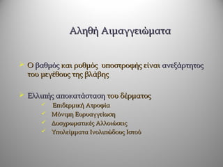 Αληθή Αιμαγγειώματα


 Ο βαθμός και ρυθμός υποστροφής είναι ανεξάρτητος
  του μεγέθους της βλάβης

 Ελλιπής αποκατάσταση του δέρματος
       Επιδερμική Ατροφία
       Μόνιμη Ευρυαγγείωση
       Δυσχρωματικές Αλλοιώσεις
       Υπολείμματα Ινολιπώδους Ιστού
 