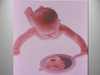 Αιμαγγειώματα και Αγγειακές Δυσπλασίες στα παιδιά - Πότε επεμβαίνουμε με Laser