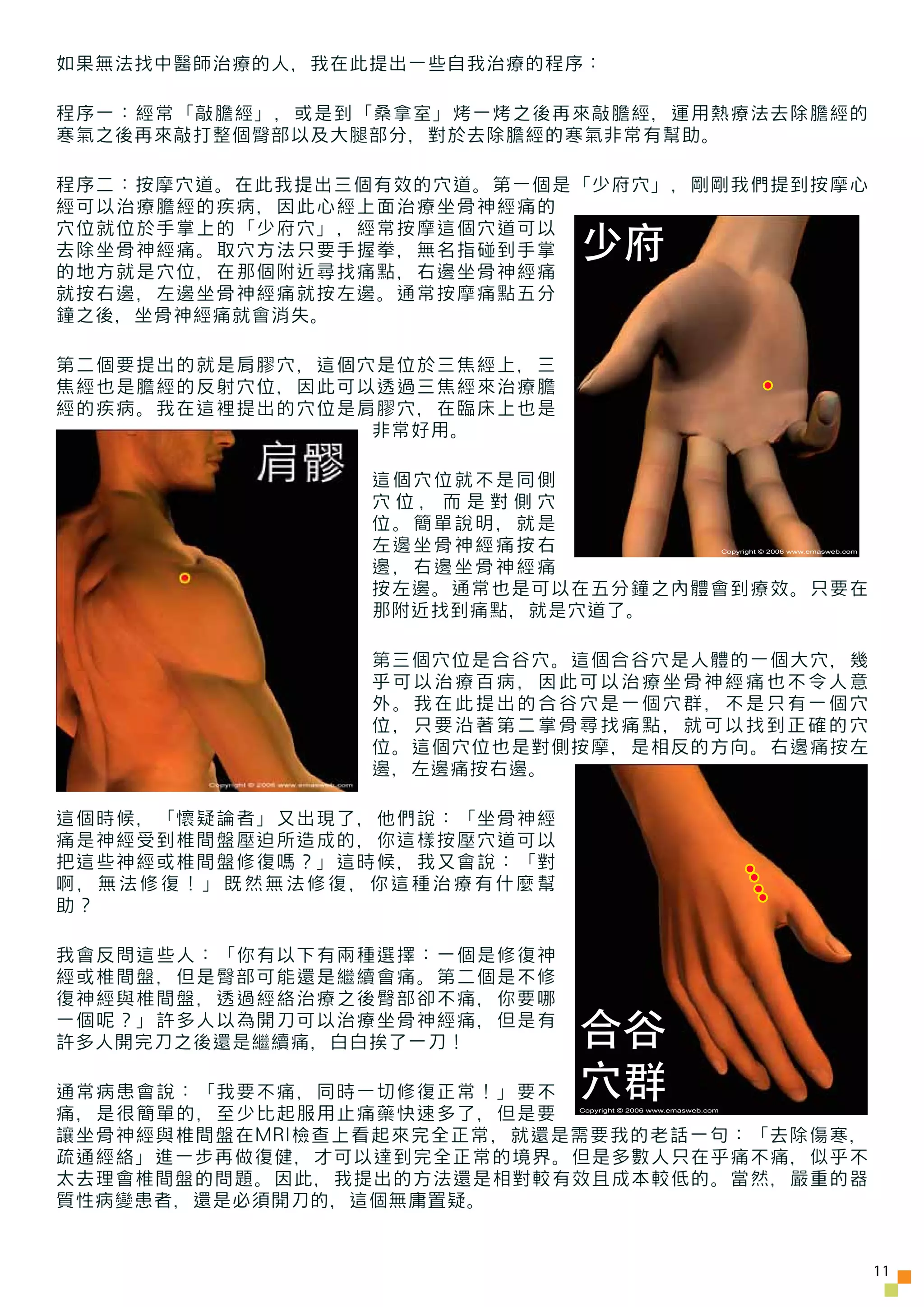 如果無法找中醫師治療的人，我在此提出一些自我治療的程序：

程序一：經常「敲膽經」，或是到「桑拿室」烤一烤之後再來敲膽經，運用熱療法去除膽經的
寒氣之後再來敲打整個臀部以及大腿部分，對於去除膽經的寒氣非常有幫助。

程序二：按摩穴道。在此我提出三個有效的穴道。第一個是「少府穴」，剛剛我們提到按摩心
經可以治療膽經的疾病，因此心經上面治療坐骨神經痛的

                            少府
穴位就位於手掌上的「少府穴」，經常按摩這個穴道可以
去除坐骨神經痛。取穴方法只要手握拳，無名指碰到手掌
的地方就是穴位，在那個附近尋找痛點，右邊坐骨神經痛
就按右邊，左邊坐骨神經痛就按左邊。通常按摩痛點五分
鐘之後，坐骨神經痛就會消失。

第二個要提出的就是肩膠穴，這個穴是位於三焦經上，三
焦經也是膽經的反射穴位，因此可以透過三焦經來治療膽
經的疾病。我在這裡提出的穴位是肩膠穴，在臨床上也是
                非常好用。

                這個穴位就不是同側
                穴位，而是對側穴
                位。簡單說明，就是
                左邊坐骨神經痛按右                                      Copyright © 2006 www.emasweb.com


                邊，右邊坐骨神經痛
                按左邊。通常也是可以在五分鐘之內體會到療效。只要在
                那附近找到痛點，就是穴道了。

                第三個穴位是合谷穴。這個合谷穴是人體的一個大穴，幾
                乎可以治療百病，因此可以治療坐骨神經痛也不令人意
                外。我在此提出的合谷穴是一個穴群，不是只有一個穴
                位，只要沿著第二掌骨尋找痛點，就可以找到正確的穴
                位。這個穴位也是對側按摩，是相反的方向。右邊痛按左
                邊，左邊痛按右邊。

這個時候，「懷疑論者」又出現了，他們說：「坐骨神經
痛是神經受到椎間盤壓迫所造成的，你這樣按壓穴道可以
把這些神經或椎間盤修復嗎？」這時候，我又會說：「對
啊，無法修復！」既然無法修復，你這種治療有什麼幫
助？

我會反問這些人：「你有以下有兩種選擇：一個是修復神
經或椎間盤，但是臀部可能還是繼續會痛。第二個是不修
復神經與椎間盤，透過經絡治療之後臀部卻不痛，你要哪
一個呢？」許多人以為開刀可以治療坐骨神經痛，但是有
許多人開完刀之後還是繼續痛，白白挨了一刀！       合谷
通常病患會說：「我要不痛，同時一切修復正常！」要不
痛，是很簡單的，至少比起服用止痛藥快速多了，但是要
                            穴群
                            Copyright © 2006 www.emasweb.com



讓坐骨神經與椎間盤在MRI檢查上看起來完全正常，就還是需要我的老話一句：「去除傷寒，
疏通經絡」進一步再做復健，才可以達到完全正常的境界。但是多數人只在乎痛不痛，似乎不
太去理會椎間盤的問題。因此，我提出的方法還是相對較有效且成本較低的。當然，嚴重的器
質性病變患者，還是必須開刀的，這個無庸置疑。


                                                                                                  11
 