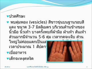 ♥ปวดศีรษะ
  ♥ พบตุ่มพอง (vesicles) สีขำวขุ่นบนฐำนรอบสี
   แดง ขนำด 3-7 มิลลิเมตร บริเวณด้ำนข้ำงของ
   นิ้วมือ นิ้วเท้ำ บำงครั้งพบที่ฝ่ำมือ ฝ่ำเท้ำ ส้นเท้ำ
   ส่วนมำกมีจำำนวน 5-6 ตุ่ม เวลำกดจะเจ็บ ส่วน
   ใหญ่ไม่ค่อยแตกเป็นแผล จะหำยไปได้เองใน
   เวลำประมำณ 1 สัปดำห์ 
  ♥เบื่ออำหำร
  ♥เด็กจะหงุดหงิด
18/08/12       น.ส.ศิรินวล สันติรักษ์โยธิน รหัส 45        11
 