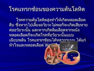 โรคแทรกซ้อนของความดันโลหิต
    โรคความดันโลหิตสูงทำาให้เกิดหลอดเลือด
ตีบ ซึ่งหากไปเลี้ยงอวัยวะไม่พอก็จะเกิดเสียหาย
ต่ออวัยวะนั้น และหากเกิดลิ่มเลือดจากผนัง
หลอดเลือดก็จะเกิดโรคที่อวัยวะนั้นแบบ
เฉียบพลัน โรคแทรกซ้อนได้หลายระบบ ได้แก่
หัวใจและหลอดเลือด สมอง ไต เท้า ตา
 