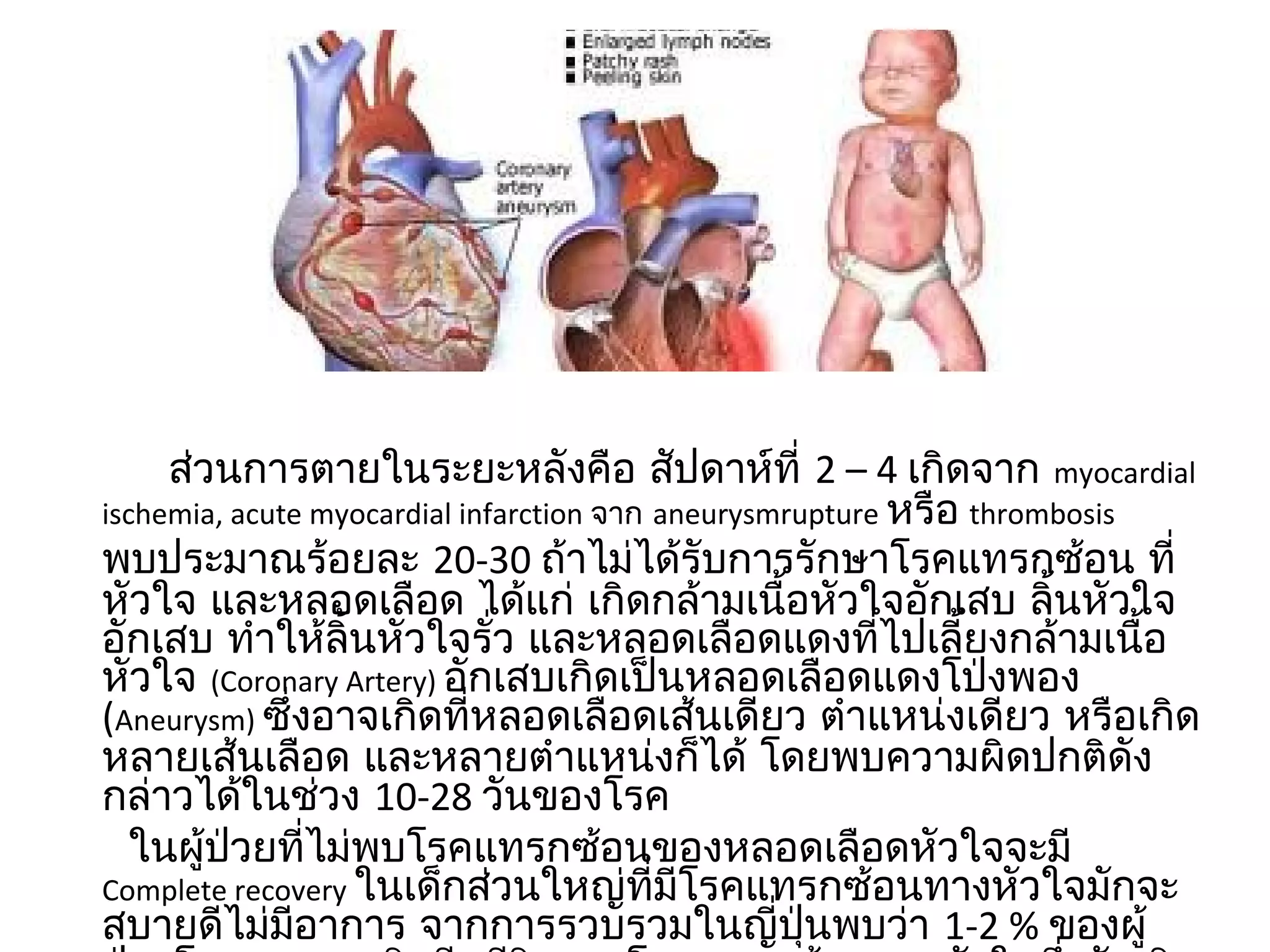 ส่วนกำรตำยในระยะหลังคือ สัปดำห์ที่ 2 – 4 เกิดจำก myocardial
ischemia, acute myocardial infarction จำก aneurysmrupture หรือ thrombosis
พบประมำณร้อยละ 20-30 ถ้ำไม่ได้รับกำรรักษำโรคแทรกซ้อน ที่
หัวใจ และหลอดเลือด ได้แก่ เกิดกล้ำมเนื้อหัวใจอักเสบ ลิ้นหัวใจ
อักเสบ ทำำให้ลิ้นหัวใจรั่ว และหลอดเลือดแดงที่ไปเลี้ยงกล้ำมเนื้อ
หัวใจ (Coronary Artery) อักเสบเกิดเป็นหลอดเลือดแดงโป่งพอง
(Aneurysm) ซึ่งอำจเกิดที่หลอดเลือดเส้นเดียว ตำำแหน่งเดียว หรือเกิด
หลำยเส้นเลือด และหลำยตำำแหน่งก็ได้ โดยพบควำมผิดปกติดัง
กล่ำวได้ในช่วง 10-28 วันของโรค
   ในผู้ป่วยที่ไม่พบโรคแทรกซ้อนของหลอดเลือดหัวใจจะมี
Complete recovery ในเด็กส่วนใหญ่ที่มีโรคแทรกซ้อนทำงหัวใจมักจะ
สบำยดีไม่มีอำกำร จำกกำรรวบรวมในญี่ปุ่นพบว่ำ 1-2 % ของผู้
 