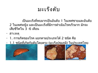 มะเร็ง ตับ
            เป็นมะเร็งที่พบมากเป็นอันดับ 1 ในเพศชายและอันดับ
  2 ในเพศหญิง และเป็นมะเร็งที่มีการดำาเนินโรคเร็วมาก มักจะ
  เสียชีวิตใน 3 -6 เดือน
• สาเหตุ
• 1. การเกิดของโรค แยกตามประเภทได้ 2 ชนิด คือ
• 1.1 ชนิดที่เกิดกับตับโดยตรง (มะเร็งปฐมภูมิ) ในประเทศไทย
  พบมากมี 2 ชนิดคือ
 