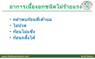 อาการเนื้อ งอกชนิด ไม่ร ้า ยแรง

       •   คลำา พบก้อ นที่เ ต้า นม
       •   ไม่ป วด
       •   ก้อ นไม่แ ข็ง
       •   ก้อ นกลิ้ง ได้



www.thaibreastcancer.com             by Dr.Hasun
 