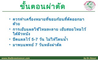 ขั้น ตอนผ่า ตัด
      • ควรทำา เครื่อ งหมายทีข อบก้อ นทีต ัด ออกมา
                             ่            ่
        ด้ว ย
      • การเย็บ แผลใช้ไ หมละลาย เย็บ สอยไหมไว้
        ใต้ผ ิว หนัง
      • ปิด แผลไว้ 5-7 วัน ไม่ใ ห้โ ดนนำ้า
      • มาพบแพทย์ 7 วัน หลัง ผ่า ตัด


www.thaibreastcancer.com                        by Dr.Hasun
 
