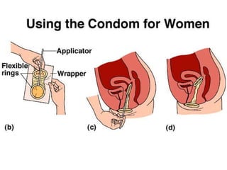 การสืบพันธ์